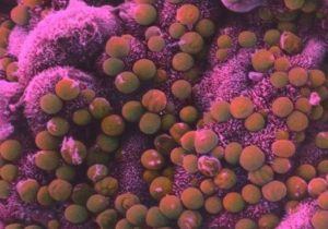 cryptosporidium-300x210.jpg